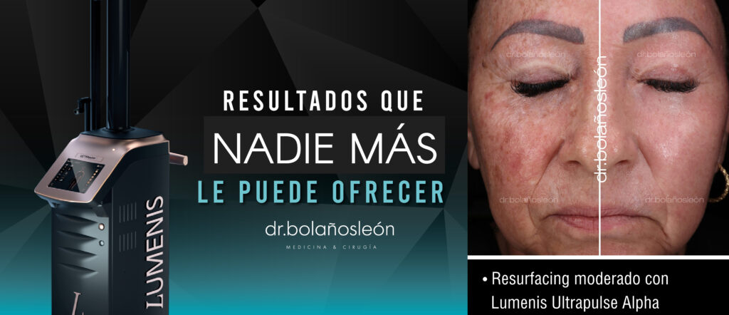 Resultado real de Lumenis Ultrapulse Alpha